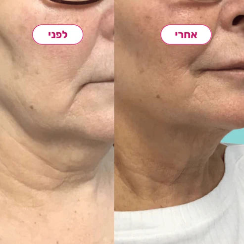 💆‍♀️ לפני ואחרי – ההבדל שמרגישים ורואים